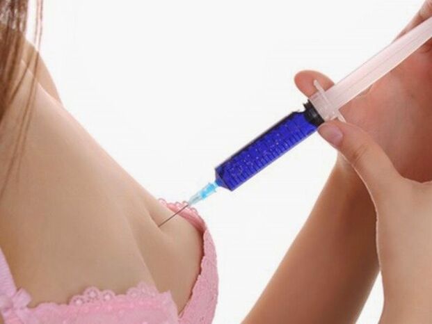 Hyaluronsäure Injektiounen fir Brustvergréisserung