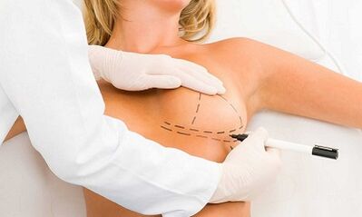 Wéi d'Zerbrals vun Implantater erhéijen