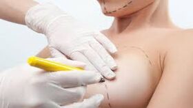 Broschtverbraucher Chirurgie