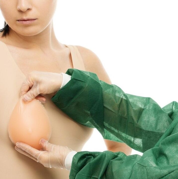 Brustvergréisserung Implantate